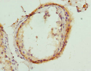 HMGCL Antibody