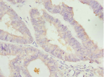 LEFTY2 Antibody