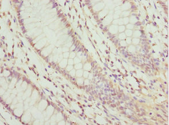 LEFTY2 Antibody