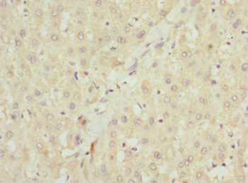 NHLRC1 Antibody
