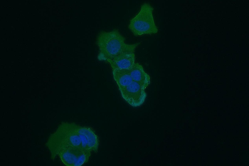 NHLRC1 Antibody