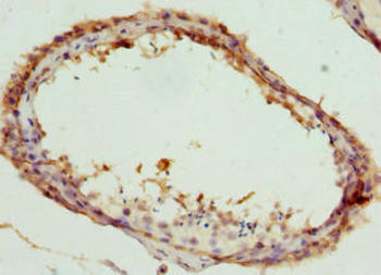CCT5 Antibody