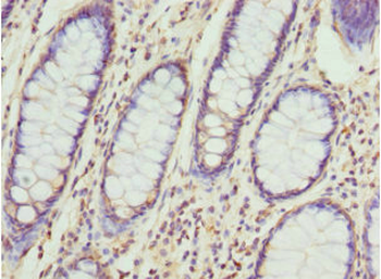 CCT5 Antibody