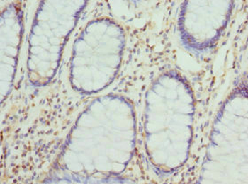 CYTH2 Antibody