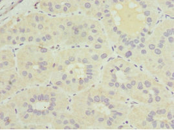 GDAP1 Antibody