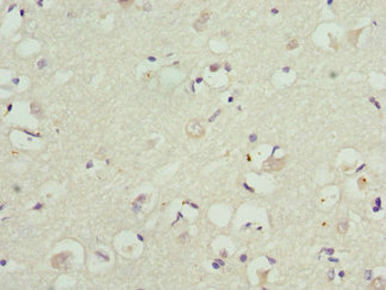 KCNIP2 Antibody