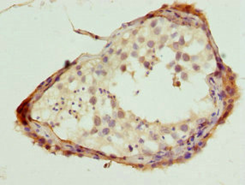 NLK Antibody