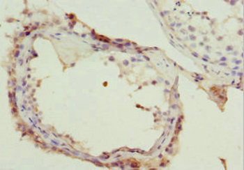 NSFL1C Antibody