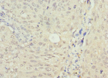 NSFL1C Antibody