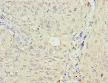 RAE1 Antibody