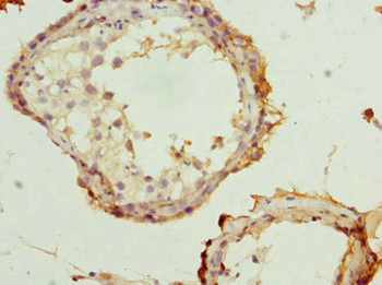 RTKN Antibody