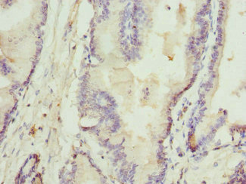 RTKN Antibody