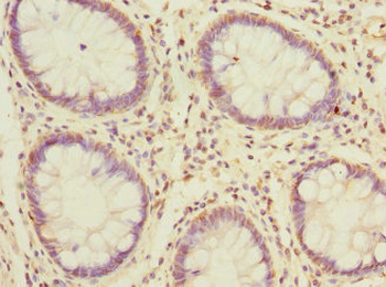 MSRB2 Antibody