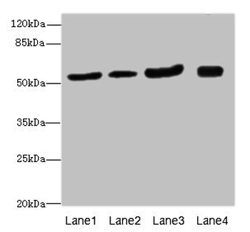 ANTXR2 Antibody