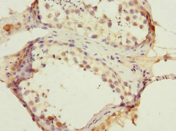 ANTXR2 Antibody