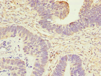 ANTXR2 Antibody