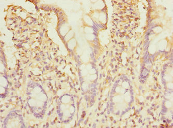 STX7 Antibody