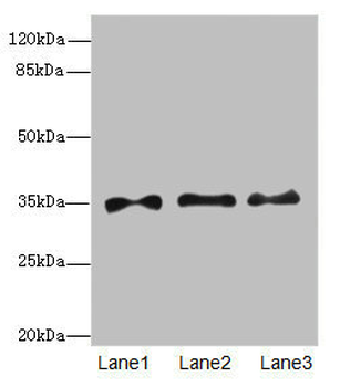 PRPS1 Antibody