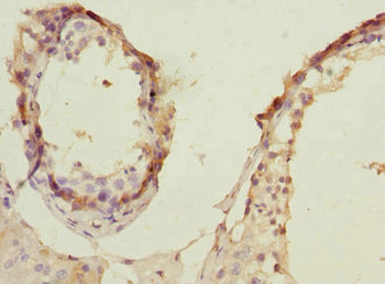 PRPS1 Antibody