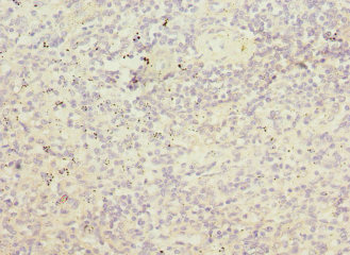 PRPS1 Antibody