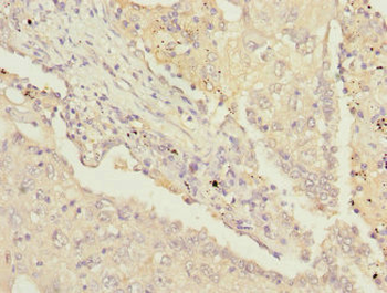 PSMD13 Antibody