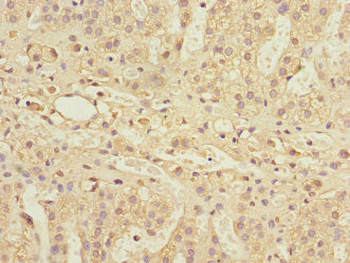 PSMD13 Antibody