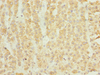 ELMOD1 Antibody