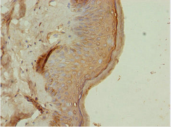 ATMIN Antibody