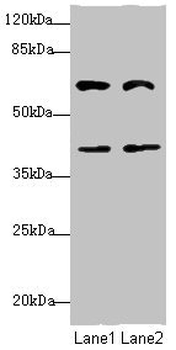 DCP1A Antibody