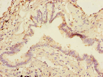 DCP1A Antibody