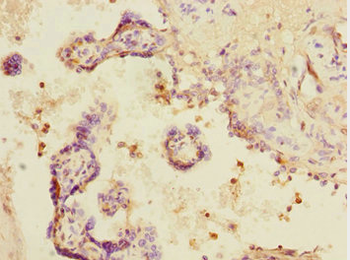 DCP1A Antibody
