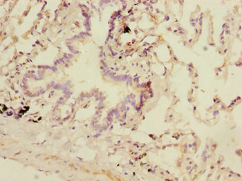 DCP1A Antibody
