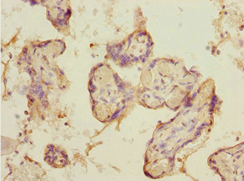 DCP1A Antibody