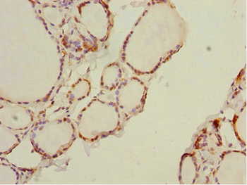 DTX2 Antibody