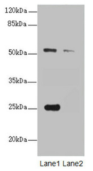 ERO1A Antibody
