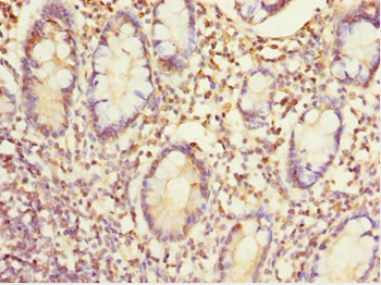 EYA3 Antibody