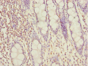 SUPT20H Antibody