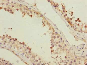 SUPT20H Antibody