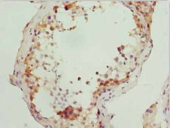 RUFY2 Antibody
