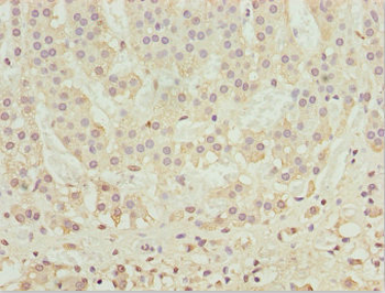 RUFY2 Antibody