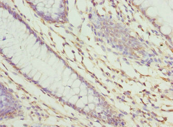 ZNF324 Antibody
