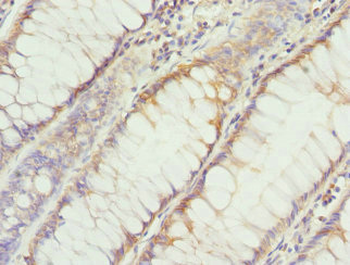 DHDDS Antibody