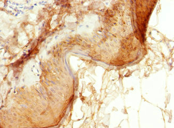EPS15L1 Antibody