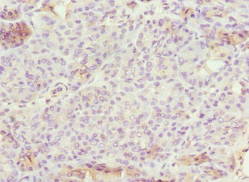 EPS15L1 Antibody