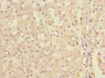 KHK Antibody