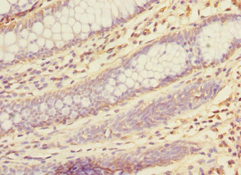 KHK Antibody