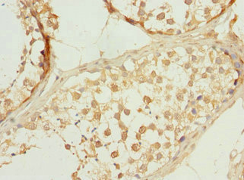 PPP3R2 Antibody
