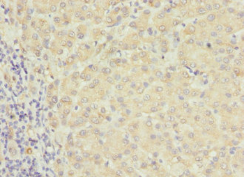 RAB17 Antibody