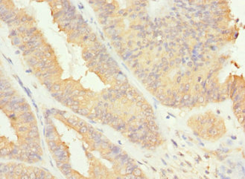 RAB17 Antibody