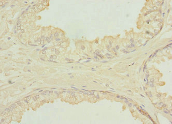 SH3GLB2 Antibody